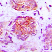 GPR160 Rabbit Polyclonal Antibody