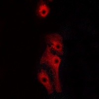 GPR160 Rabbit Polyclonal Antibody