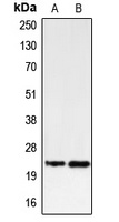 PUMA Antibody