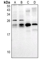 RAB30 Rabbit Polyclonal Antibody