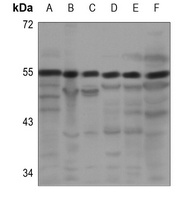 PRPF19 Rabbit Polyclonal Antibody