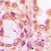 PRPF19 Rabbit Polyclonal Antibody