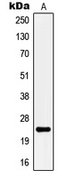 KCNMB4 Rabbit Polyclonal Antibody