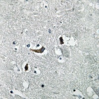 KCNMB4 Rabbit Polyclonal Antibody