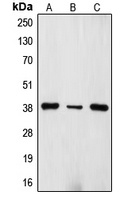 TRBC1 Rabbit Polyclonal Antibody