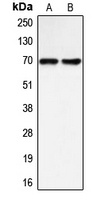 BLNK Rabbit Polyclonal Antibody