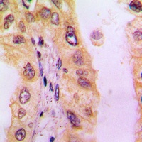 BLNK Rabbit Polyclonal Antibody