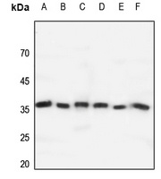 GPR171 Rabbit Polyclonal Antibody