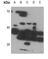 ZDHHC9 Rabbit Polyclonal Antibody