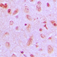 ZDHHC9 Rabbit Polyclonal Antibody