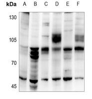 Cytochrome P450 39A1 Rabbit Polyclonal Antibody