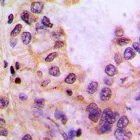 Cytochrome P450 39A1 Rabbit Polyclonal Antibody