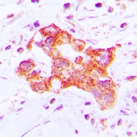 Cytochrome P450 39A1 Rabbit Polyclonal Antibody