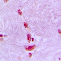 CDC40 Rabbit Polyclonal Antibody