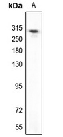 UBR5 Antibody [KO/KD Validated]