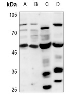 PPHLN1 Rabbit Polyclonal Antibody