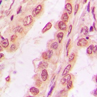 PPHLN1 Rabbit Polyclonal Antibody