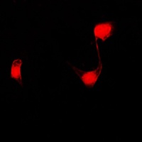 PPHLN1 Rabbit Polyclonal Antibody