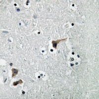 ATP6V1H Rabbit Polyclonal Antibody