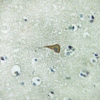 IL-20RA Antibody
