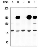Cyclin M2 Rabbit Polyclonal Antibody