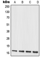 MRPL20 Rabbit Polyclonal Antibody