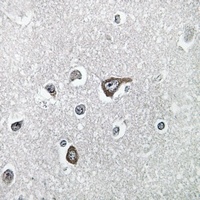MRPL20 Rabbit Polyclonal Antibody