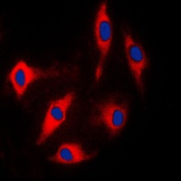 ARHGAP17 Rabbit Polyclonal Antibody