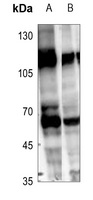 RCBTB1 Antibody