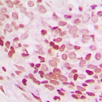 NEIL3 Rabbit Polyclonal Antibody