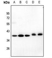 GIMAP4 Rabbit Polyclonal Antibody