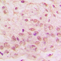 GIMAP4 Rabbit Polyclonal Antibody