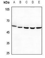 PPP4R1L Rabbit Polyclonal Antibody