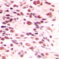 LYAR Rabbit Polyclonal Antibody