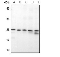 RAB20 Rabbit Polyclonal Antibody
