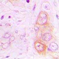 RAB20 Rabbit Polyclonal Antibody