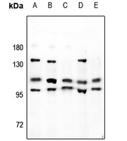 NBPF-pan Rabbit Polyclonal Antibody