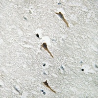 NBPF-pan Rabbit Polyclonal Antibody