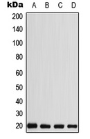 CABP5 Rabbit Polyclonal Antibody