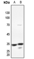 PMEPA1 Rabbit Polyclonal Antibody