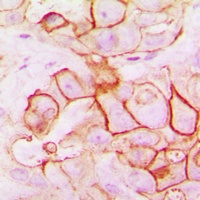 PMEPA1 Rabbit Polyclonal Antibody