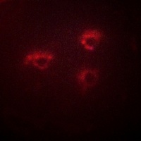 PMEPA1 Rabbit Polyclonal Antibody