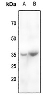 CABP4 Rabbit Polyclonal Antibody
