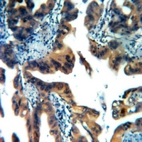 CABP4 Rabbit Polyclonal Antibody