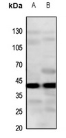 CYSLTR2 Rabbit Polyclonal Antibody