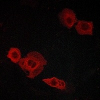 CYSLTR2 Rabbit Polyclonal Antibody