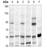 CD248 Rabbit Polyclonal Antibody
