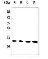 CTDSP1 Antibody
