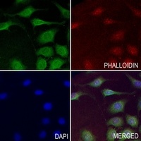 TRPV4 Rabbit Polyclonal Antibody