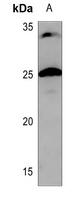 CHP2 Antibody